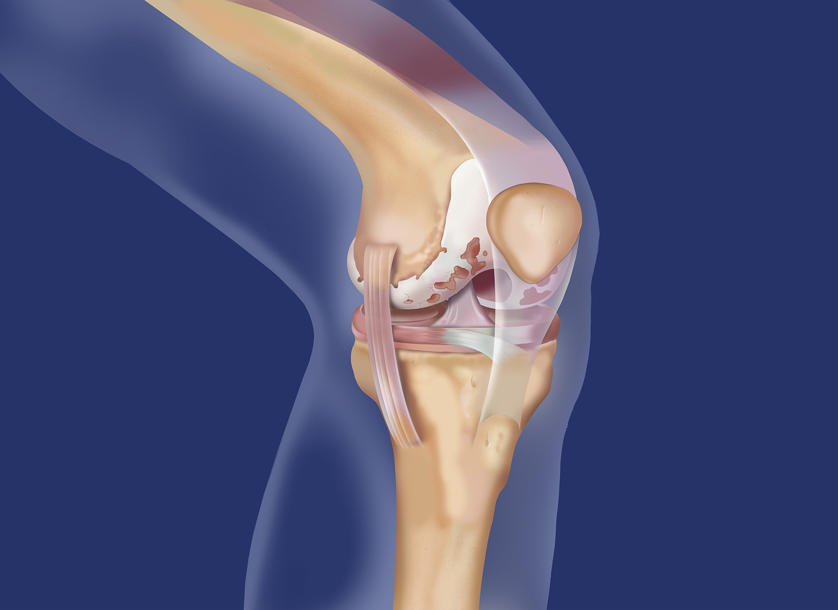 Knee  ditki medical and biological sciences