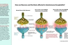 How are Neurons and the Brain Affected by AE?