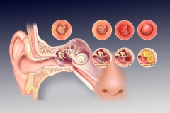 Pathology of the Ear