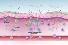 UC-inflammation