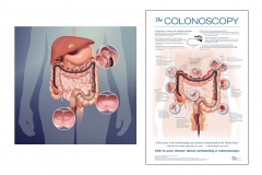Colonoscopy